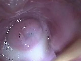 Stick in Baby batter Jizz in Cervix Not far from Flourishing Pussy Reflector